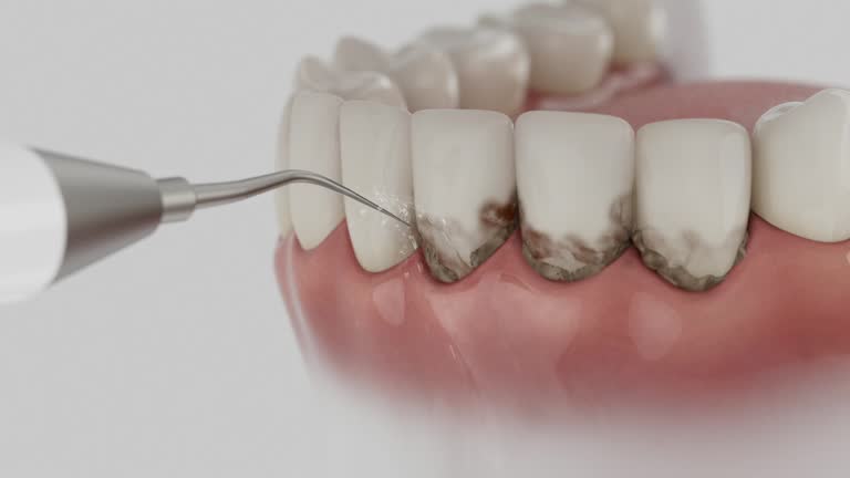 Reliable Dental contractor in Iota, LA by Smile Center Dentistry